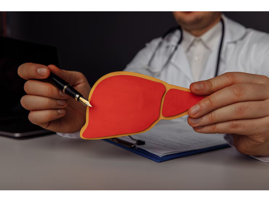 Causes of High Bilirubin